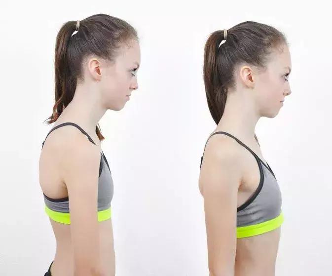 “减负”太遥远,现在我只想保住孩子的颈椎