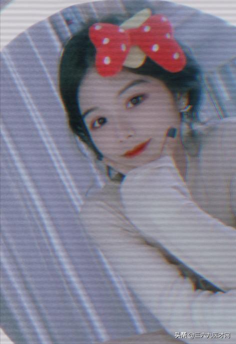 龅牙矫正成功的图片对比,2周岁龅牙可以矫正吗