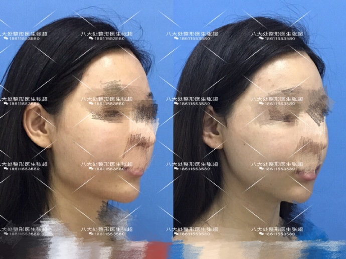 八大处张超抖音,八大处张超合集