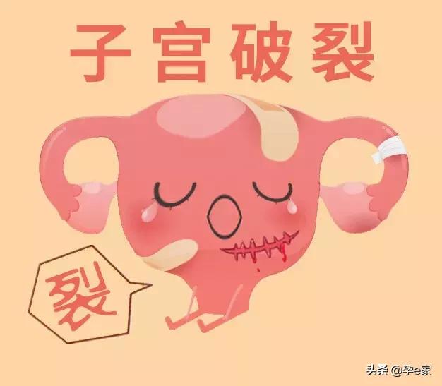 剖宫产一次比一次痛,剖宫产受罪为什么还有人剖