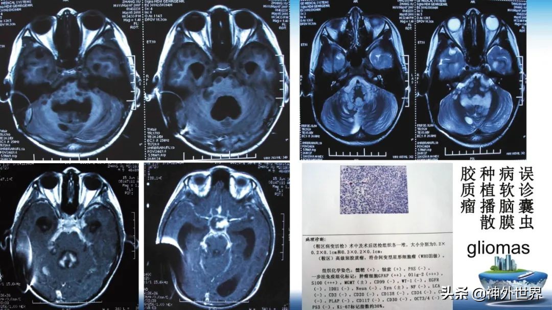 宣武医院神经外科王亚明祖籍,北京宣武医院神经科专家王亚明