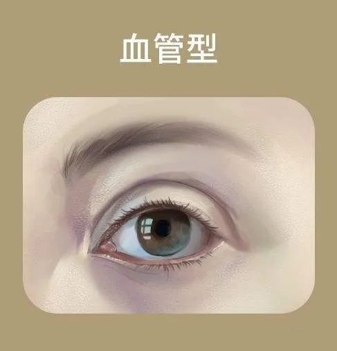 有了黑眼圈怎样改善并注意什么,有黑眼圈怎么才能让黑眼圈下去呢