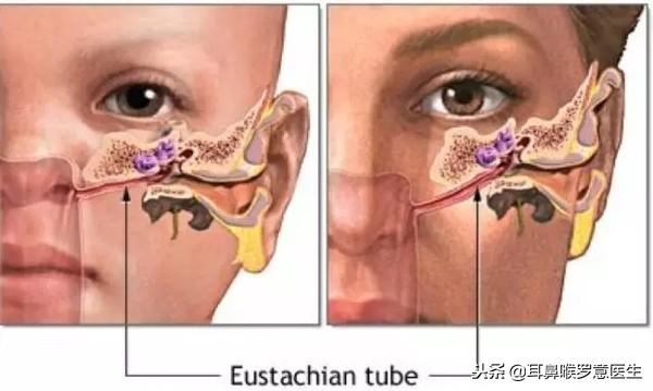 三个月宝宝耳朵流脓了怎么办,3个月宝宝耳朵流脓怎么办