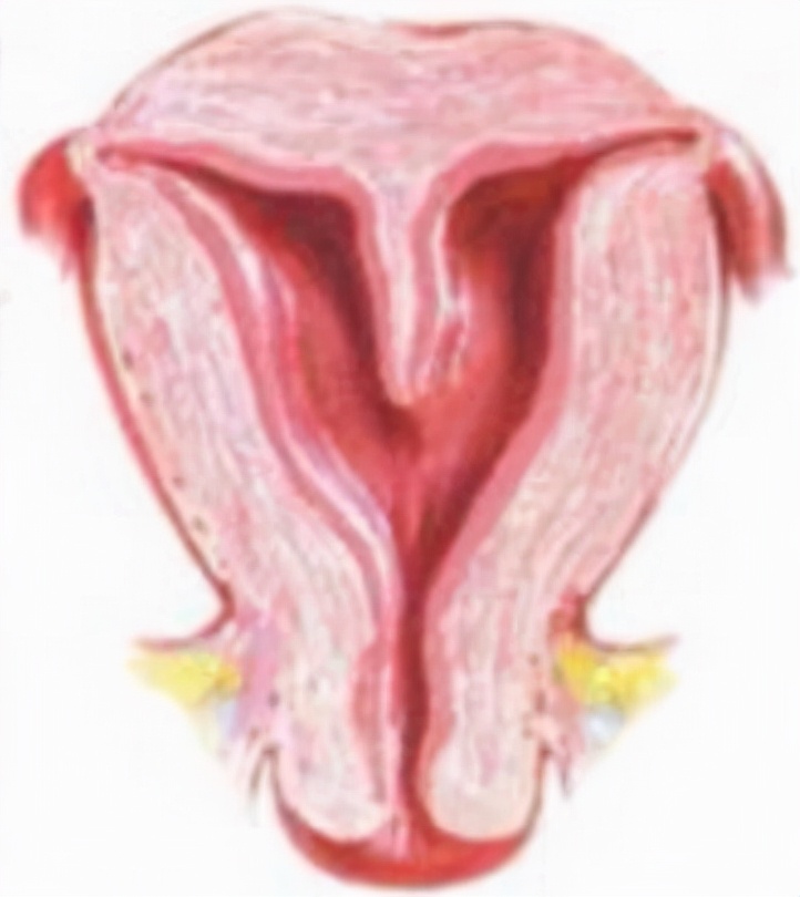 子宫畸形通过健身能改善吗,子宫畸形的最佳治疗方法