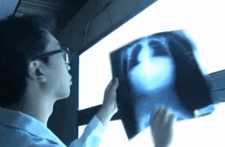 83天痛不欲生的活体腐烂，他在一次核事故后缓慢死去