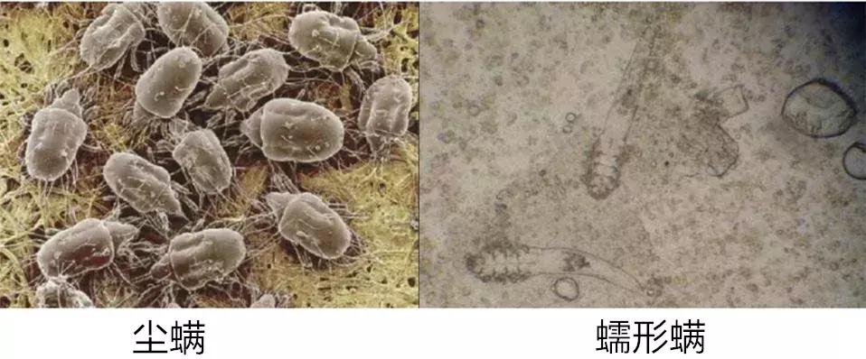 根治黑头的最佳方法,怎么才能彻底治好黑头