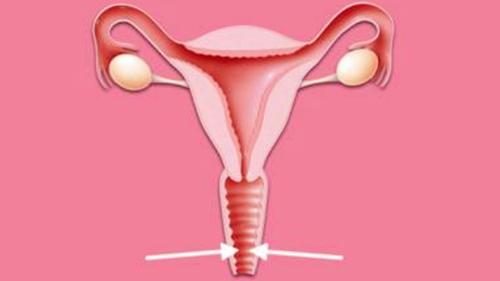 100亿活性乳酸菌,灭活乳酸杆菌