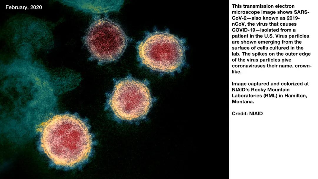 新冠病毒检测结果实验室解读,新冠病毒有哪些实验室检测方法