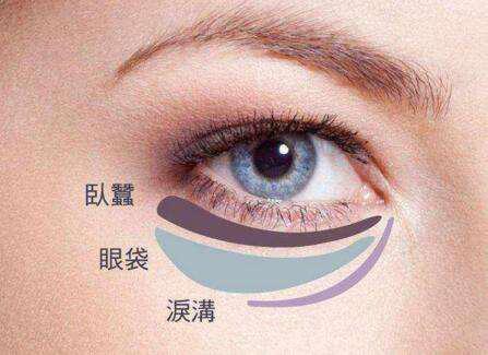 29分钟快速祛眼袋,女士微创去眼袋