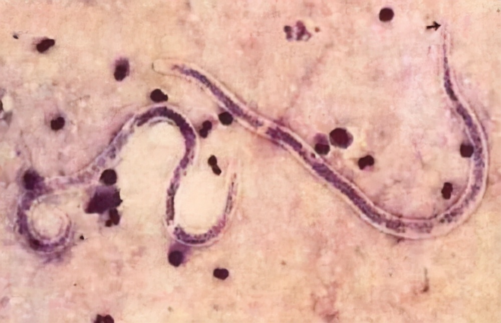 猫咪软便拉稀但是精神很好,养猫经验猫咪吐毛球拉稀怎么办