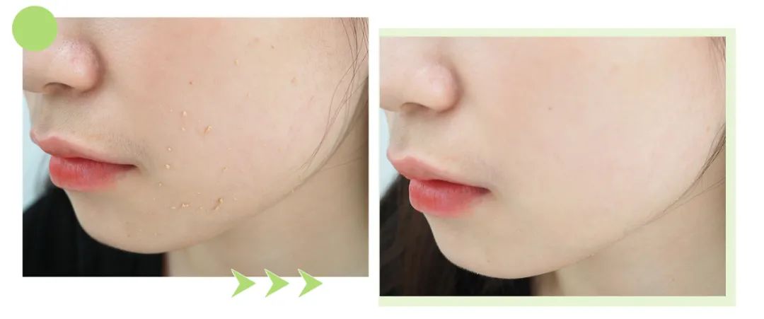 皮肤怎么变得白白嫩嫩干干净净,怎么让自己变得白白嫩嫩