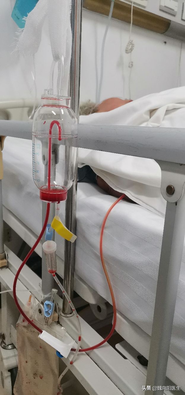 脑子里突然炸了一下,腰上有淤血要不要放血