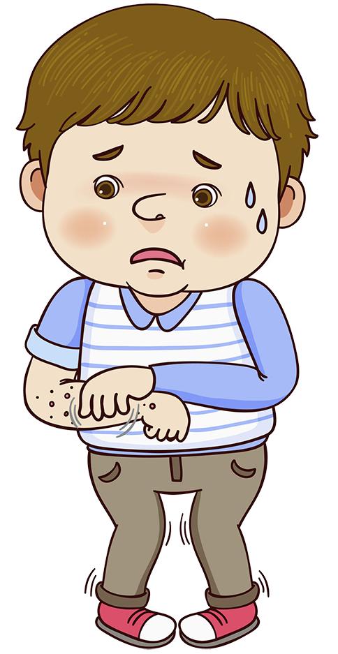 把荨麻疹误诊为夏季皮炎,常被误会为冻疮的皮肤病