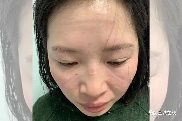 宣城人民医院感染科,宣城市人民医院感染科门诊在哪里