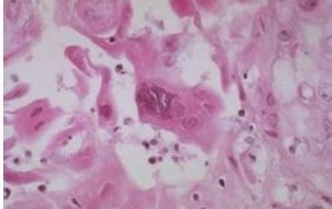 猫鼻支的症状和治疗方法,猫鼻支的症状及治疗方法