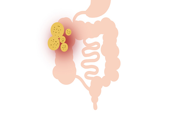 半个月没有大便感是怎么回事,十天不排便也没有便意正常吗