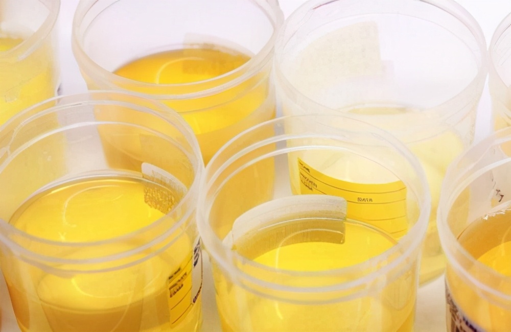 肾坏死是怎么得的,肾髓质坏死