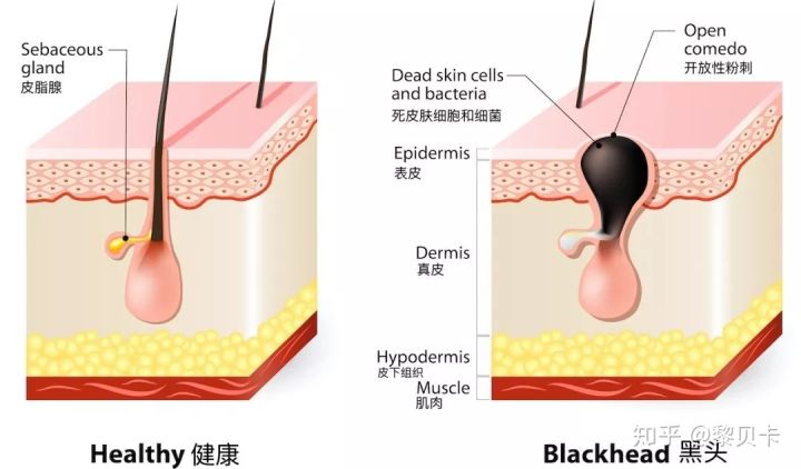 公认最好用的去黑头神器,网红推荐去黑头神器