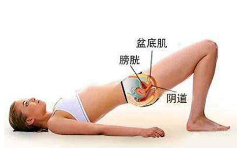 一笑尿就出来怎么治疗,一笑就尿失禁怎么快速恢复