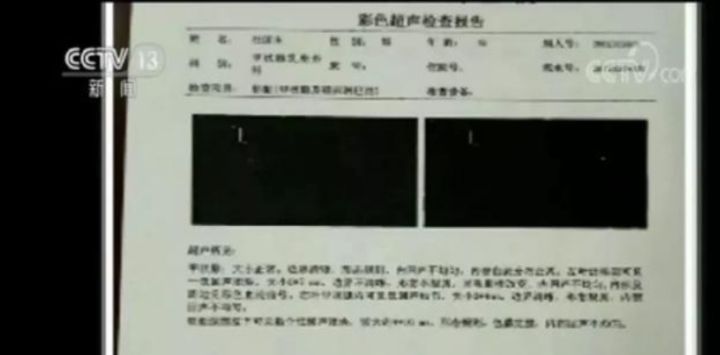 保险公司的拒赔套路大揭秘,保险公司拒赔最快最有效的方法