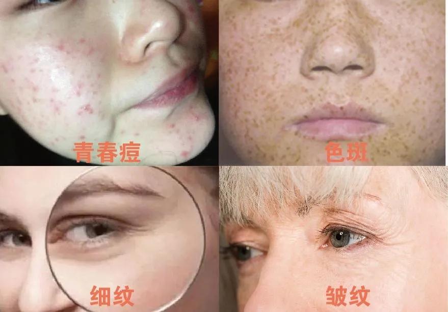 美白祛黄提亮肤色泡水喝,每天喝一杯可以美白淡斑清热解毒