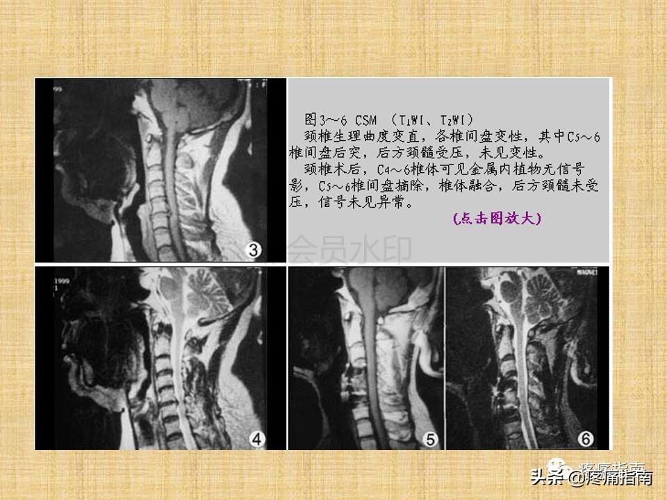中医针灸推拿学入门,真正厉害的中医推拿