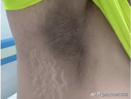 脖子发黑怎么都洗不干净怎么办,脖子发黑洗不掉像脏兮兮怎么办