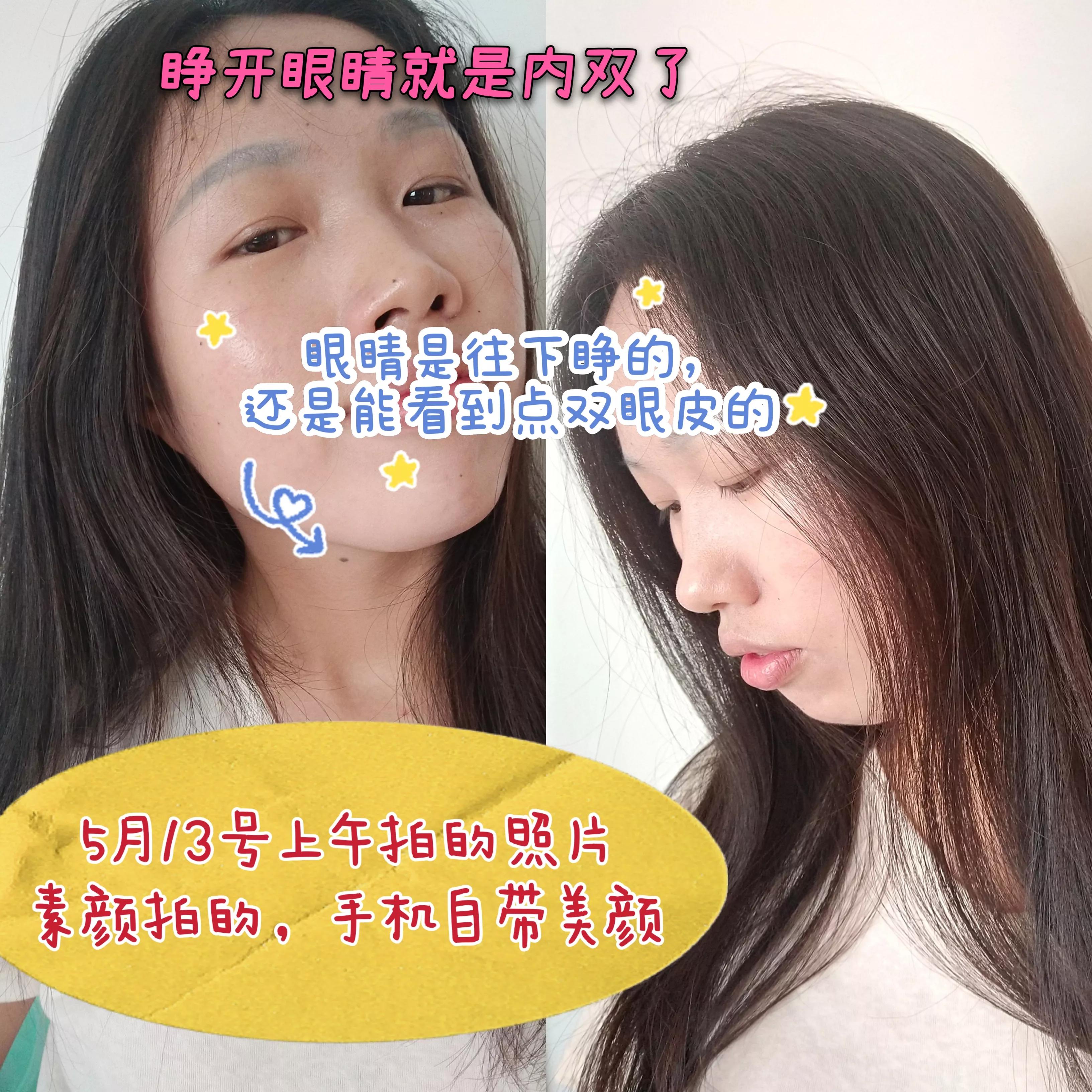 做双眼皮真的可以变好看吗,做双眼皮真的能变好看吗