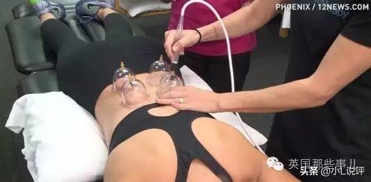 来自东方的神秘力量，让老外痴迷的拔火罐和蚊帐