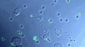 伤口结痂为什么会那么痒,伤口结痂处特别痒怎么回事