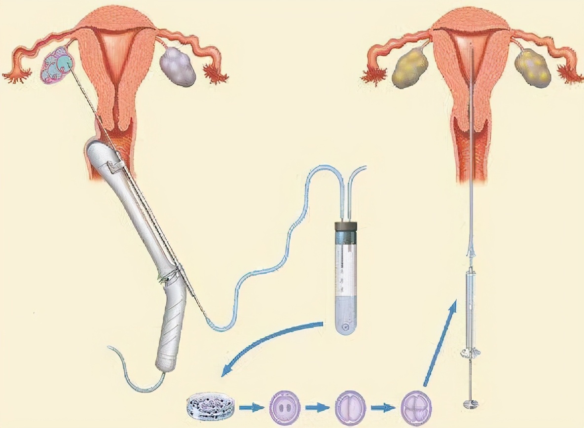 鍦嗘ⅵ鍚庣画缁撳眬闄堥槼,鍦嗘ⅵ璇曠濠村効