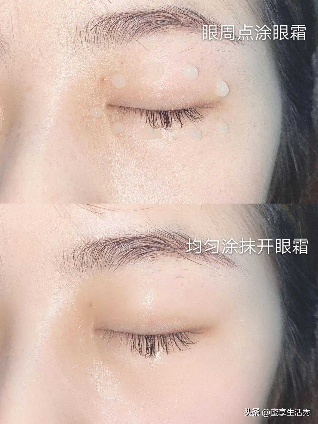 内双眼皮怎么变外双按摩最有效,内双眼皮手术变外双效果