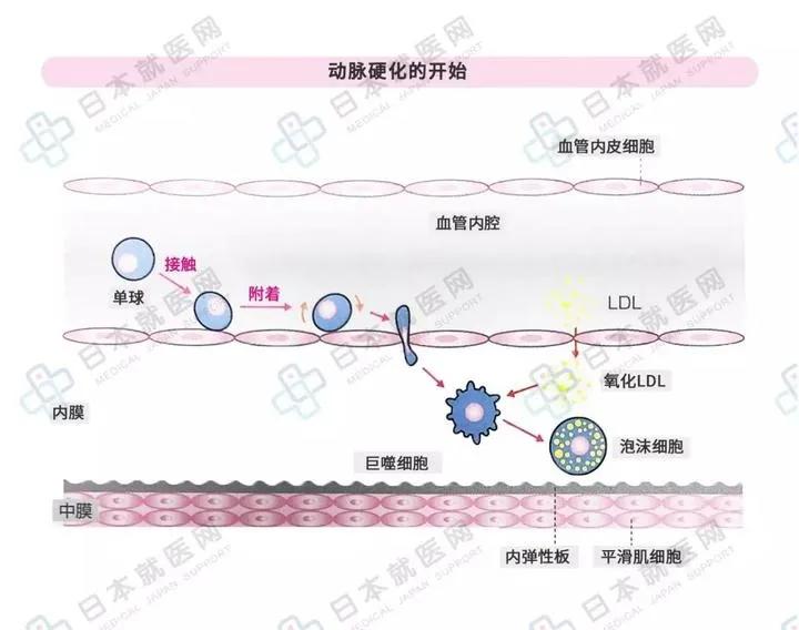 所有的炎症都是细菌感染吗,所有的疾病都是由病原体引起的吗