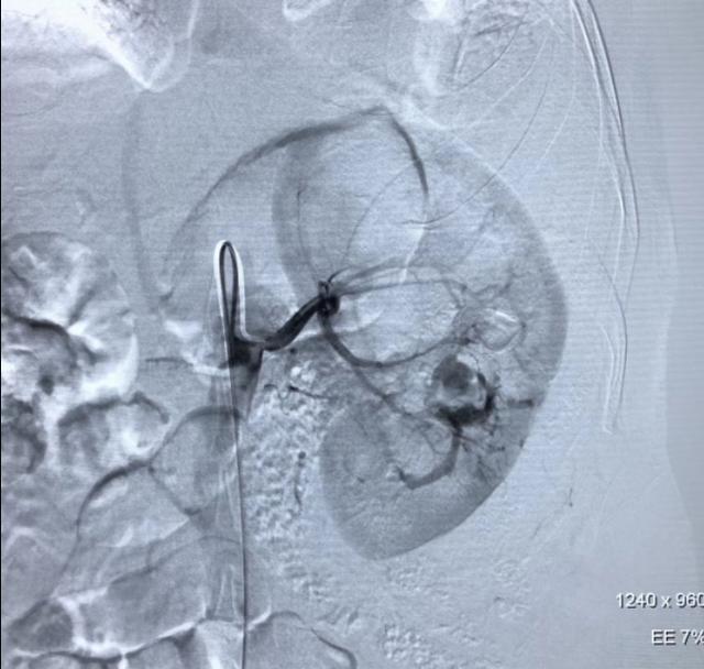 鲁渝扶贫协作简介,鲁渝扶贫协作十年成效卓著