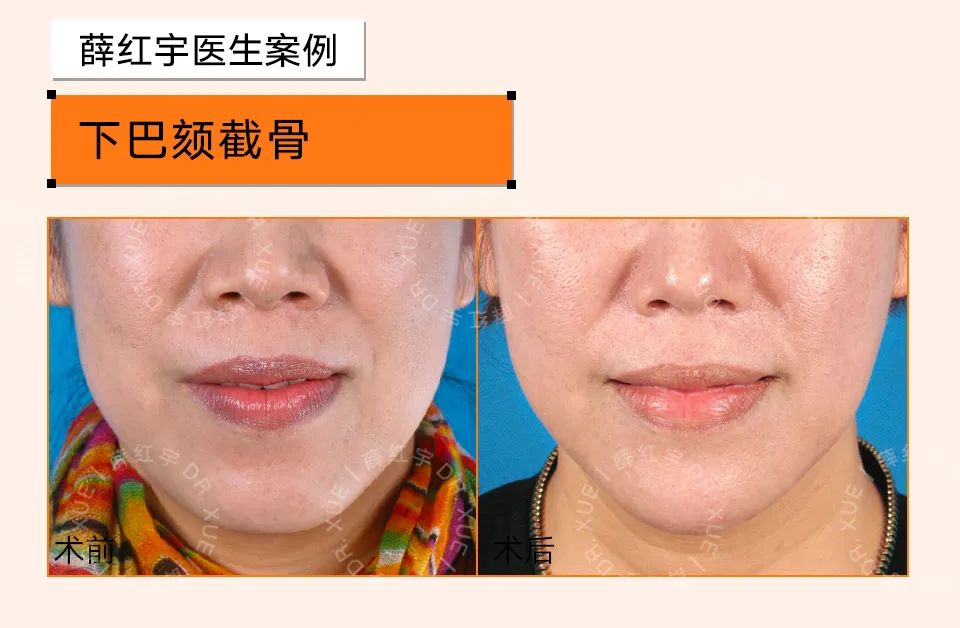 下巴宽厚的人,头尖下巴宽厚