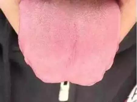 舌头出现信号对身体有什么危险,舌头出现这种症状就要警惕生病了