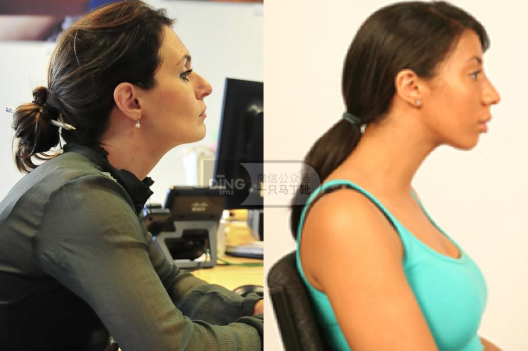 有效改善体态,提升气质减肥瘦全身方法