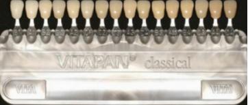 四环素牙为何会在我国盛行,四环素服用多久出现四环素牙