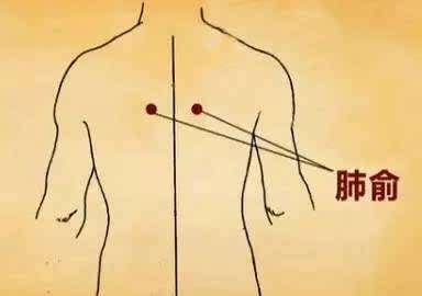 得了支气管炎咳嗽痰多怎么办,支气管炎咳嗽吐白痰能坐艾灸凳吗