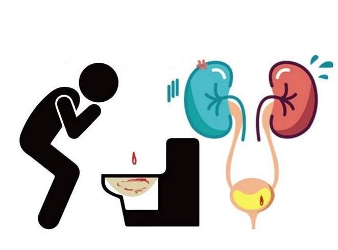 血尿和尿血有区别吗,血尿和正常尿有什么区别