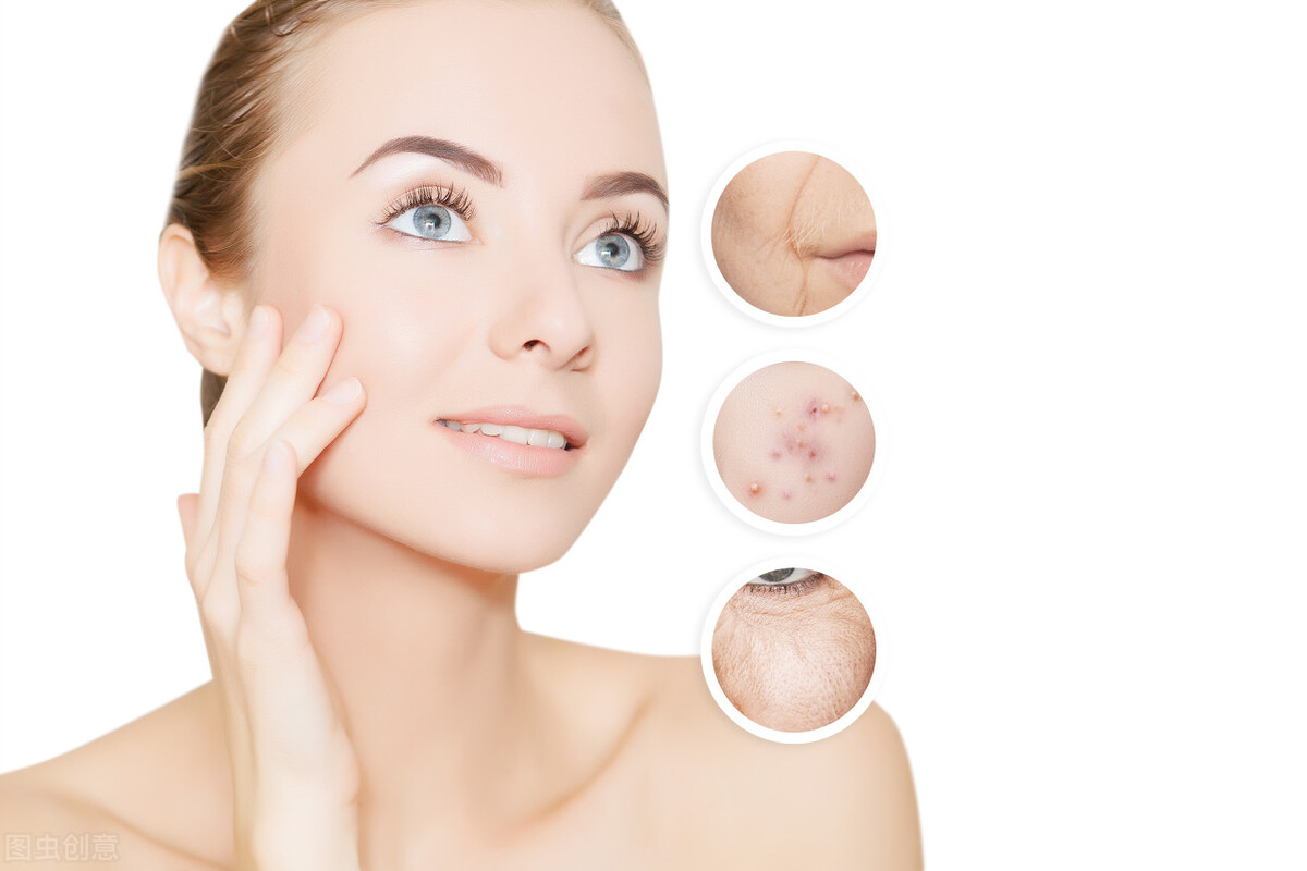 一招教你如何快速摆脱黑色痘印,如何解决烦人的痘印教你简单几招