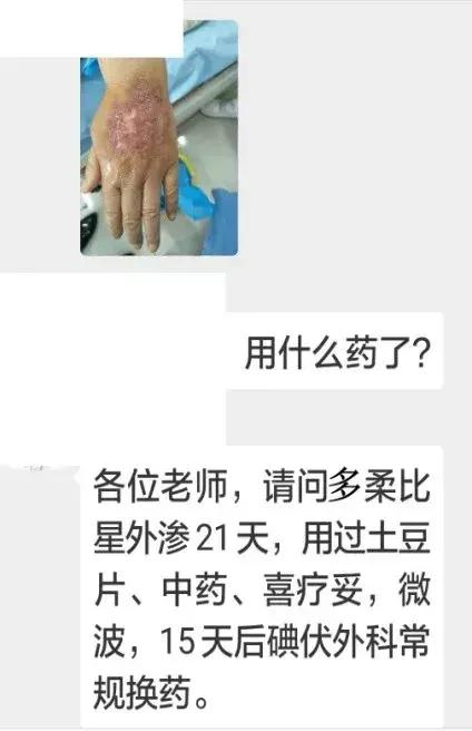 多柔比星副作用多久消除,多柔比星是最后治疗方案吗