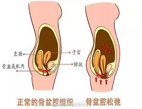 盆骨胀痛是什么原因,来大姨妈盆骨两侧酸胀