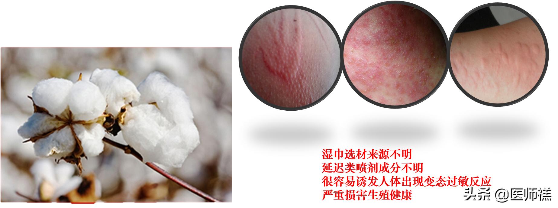 延时湿巾靠不靠谱,会带来哪些健康损害?医生提醒需要警惕这些