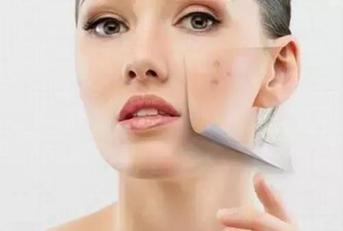 心烦易怒长痘痘怎么回事,肝火旺盛口苦脸上起痘