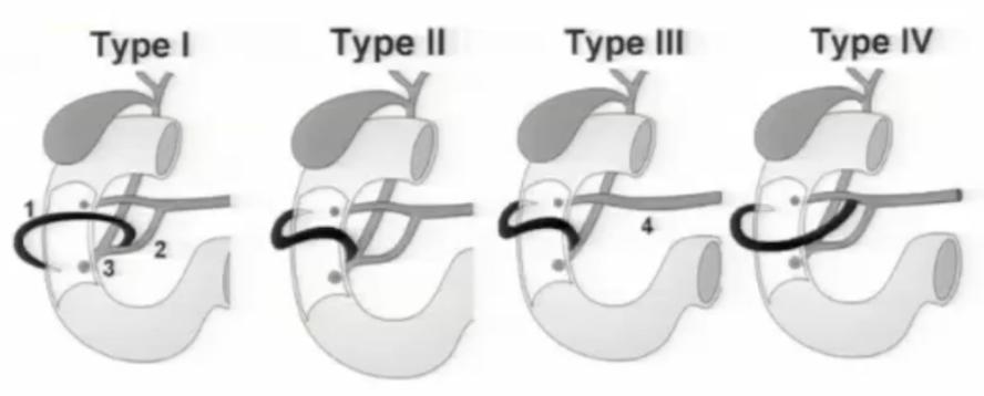 腹部ct详细讲解,腹部ct示意图及超详细教学