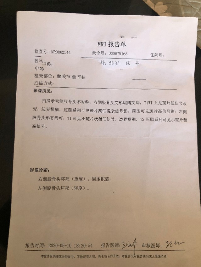 股骨头坏死医院怎么样治疗,股骨头无菌性坏死病因是多少种