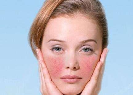 冬天一到晚脸发红发烫是怎么回事,冬天脸发红发烫该用什么护肤品