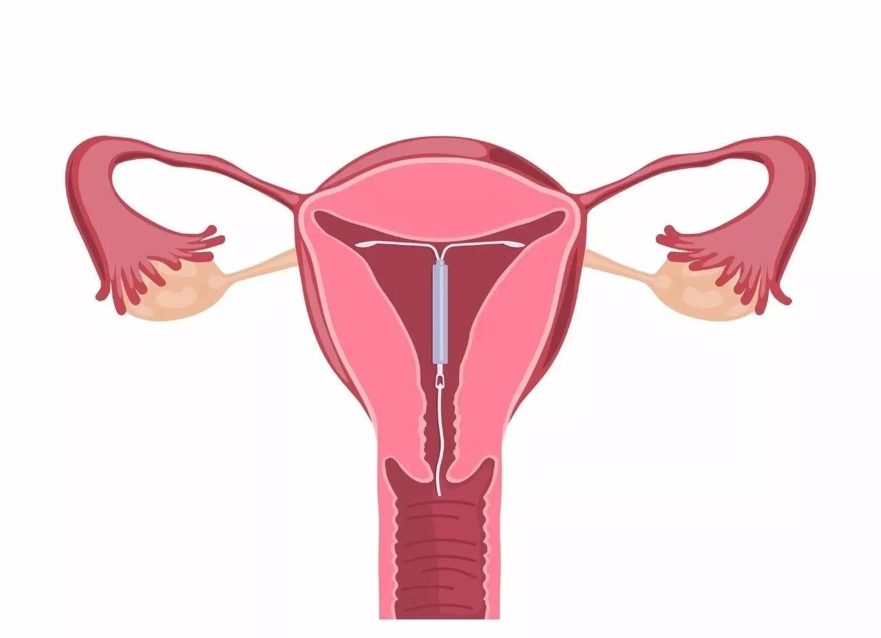 关于放环那点事儿