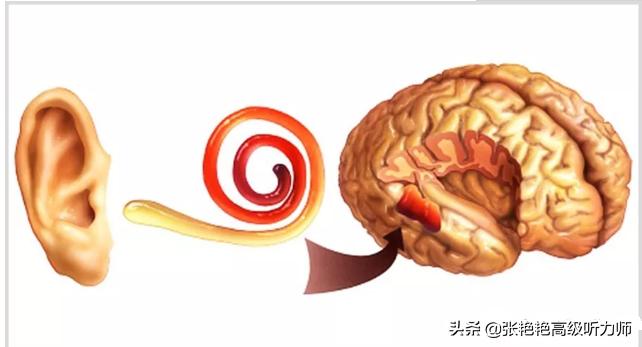 验配儿童助听器存在的五大误区,如何正确的验配助听器